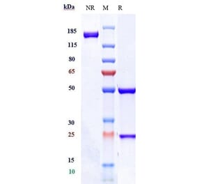 SDS-PAGE - Anti-CD37 Antibody [AGS67E] - Low endotoxin, Azide free (A323941) - Antibodies.com