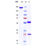 SDS-PAGE - Anti-CD4 Antibody [TRX1] - Low endotoxin, Azide free (A323943) - Antibodies.com