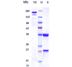SDS-PAGE - Anti-CD46 Antibody [FOR46] - Low endotoxin, Azide free (A323946) - Antibodies.com