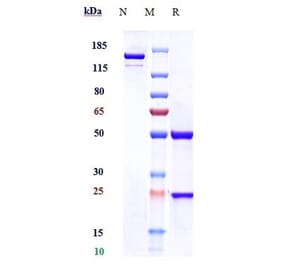 SDS-PAGE - Anti-CD5 Antibody [Research Grade Biosimilar] - Low endotoxin, Azide free (A323949) - Antibodies.com