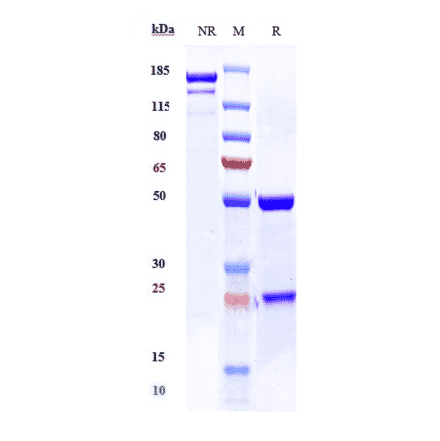 SDS-PAGE - Anti-CD59 Antibody [Research Grade Biosimilar] - Low endotoxin, Azide free (A323950) - Antibodies.com