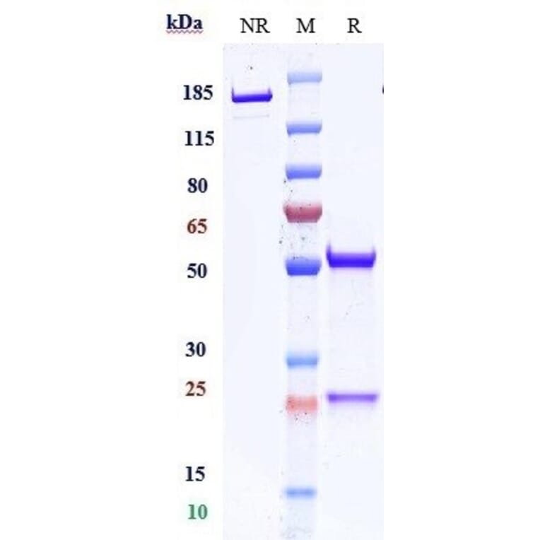 SDS-PAGE - Anti-CD59 Antibody [Research Grade Biosimilar] - Low endotoxin, Azide free (A323951) - Antibodies.com