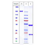 SDS-PAGE - Anti-CD64 Antibody [Research Grade Biosimilar] - Low endotoxin, Azide free (A323952) - Antibodies.com