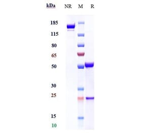 SDS-PAGE - Anti-CD69 Antibody [Research Grade Biosimilar] - Low endotoxin, Azide free (A323953) - Antibodies.com