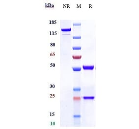 SDS-PAGE - Anti-CD7 Antibody [Research Grade Biosimilar] - Low endotoxin, Azide free (A323954) - Antibodies.com