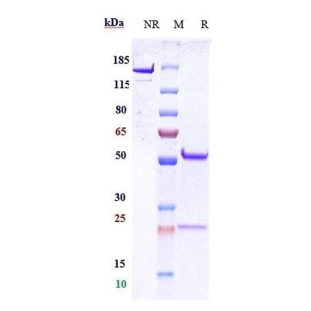 SDS-PAGE - Anti-CD9 Antibody [Research Grade Biosimilar] - Low endotoxin, Azide free (A323956) - Antibodies.com