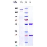 SDS-PAGE - Anti-CD98 Antibody [KHK2898] - Low endotoxin, Azide free (A323959) - Antibodies.com