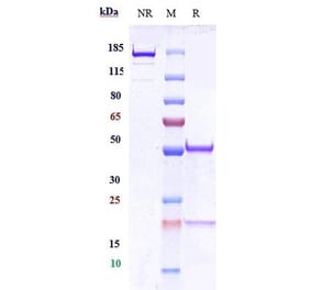 SDS-PAGE - Anti-CEACAM1 Antibody [Research Grade Biosimilar] - Low endotoxin, Azide free (A323962) - Antibodies.com