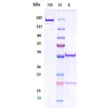 SDS-PAGE - Anti-CEACAM1 Antibody [Research Grade Biosimilar] - Low endotoxin, Azide free (A323962) - Antibodies.com
