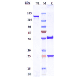 SDS-PAGE - Anti-Claudin 6 Antibody [DS-9606a] - Low endotoxin, Azide free (A323967) - Antibodies.com