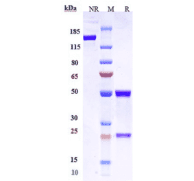 SDS-PAGE - Anti-Claudin 6 Antibody [AB1-11] - Low endotoxin, Azide free (A323969) - Antibodies.com