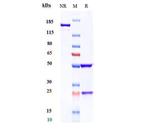 SDS-PAGE - Anti-CRTAM Antibody [Research Grade Biosimilar] - Low endotoxin, Azide free (A323980) - Antibodies.com