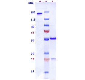 SDS-PAGE - Anti-CSF-1-R Antibody [LY3022855] - Low endotoxin, Azide free (A323982) - Antibodies.com