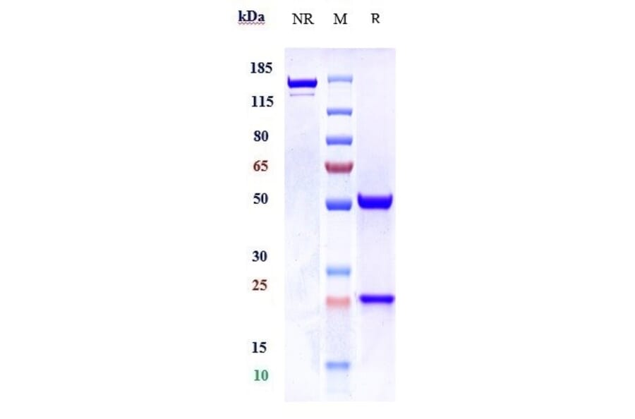 SDS-PAGE - Anti-CT B Antibody [ATH3G10] - Low endotoxin, Azide free (A323983) - Antibodies.com