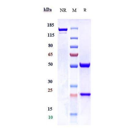 SDS-PAGE - Anti-CT B Antibody [ATH3G10] - Low endotoxin, Azide free (A323983) - Antibodies.com