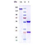 SDS-PAGE - Anti-CT B Antibody [ATH3G10] - Low endotoxin, Azide free (A323983) - Antibodies.com