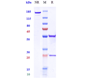 SDS-PAGE - Anti-DCSTAMP Antibody [Research Grade Biosimilar] - Low endotoxin, Azide free (A323993) - Antibodies.com