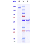 SDS-PAGE - Anti-DCSTAMP Antibody [Research Grade Biosimilar] - Low endotoxin, Azide free (A323993) - Antibodies.com