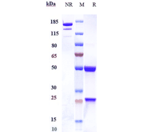 SDS-PAGE - Anti-Dectin-1 Antibody [Research Grade Biosimilar] - Low endotoxin, Azide free (A323994) - Antibodies.com