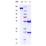 SDS-PAGE - Anti-Desmoglein 3/PVA Antibody [Research Grade Biosimilar] - Low endotoxin, Azide free (A323995) - Antibodies.com