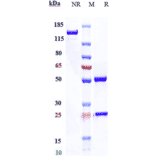 SDS-PAGE - Anti-DR6 Antibody [Research Grade Biosimilar] - Low endotoxin, Azide free (A324000) - Antibodies.com