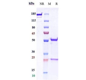SDS-PAGE - Anti-E Cadherin Antibody [Research Grade Biosimilar] - Low endotoxin, Azide free (A324002) - Antibodies.com