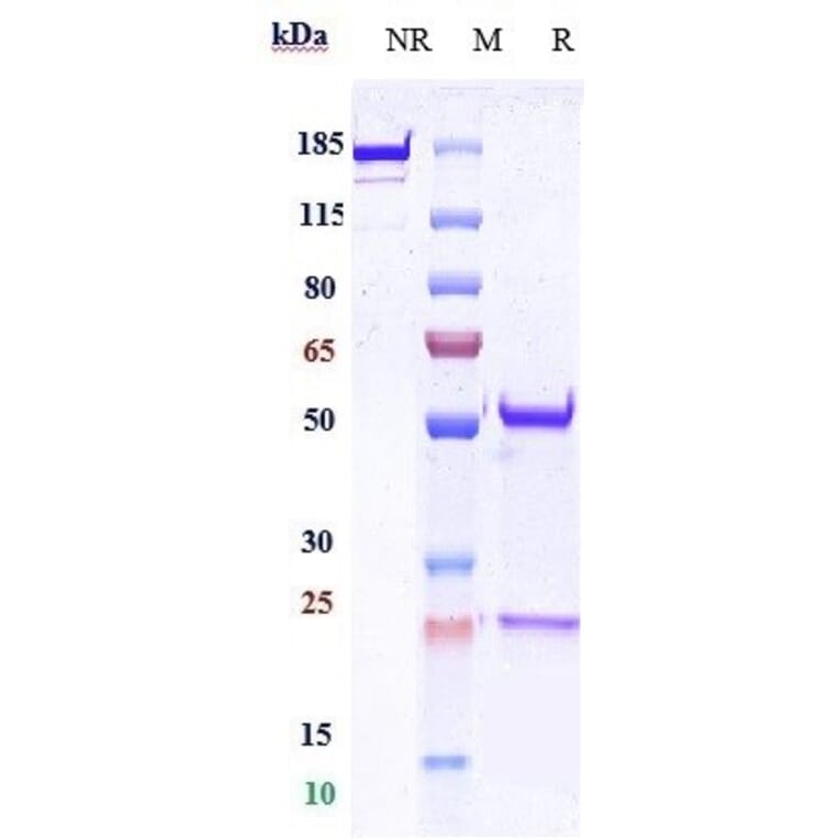 SDS-PAGE - Anti-E Cadherin Antibody [Research Grade Biosimilar] - Low endotoxin, Azide free (A324002) - Antibodies.com