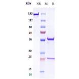 SDS-PAGE - Anti-E Cadherin Antibody [Research Grade Biosimilar] - Low endotoxin, Azide free (A324002) - Antibodies.com