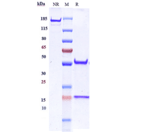 SDS-PAGE - Anti-EGFR Antibody [Research Grade Biosimilar] - Low endotoxin, Azide free (A324003) - Antibodies.com