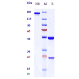 SDS-PAGE - Anti-EGFR Antibody [Research Grade Biosimilar] - Low endotoxin, Azide free (A324005) - Antibodies.com