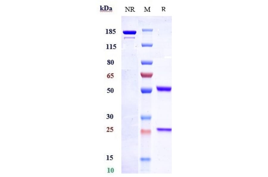 SDS-PAGE - Anti-Endothelin B Receptor/ET-B Antibody [DEDN6526A] - Low endotoxin, Azide free (A324009) - Antibodies.com