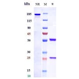 SDS-PAGE - Anti-Endothelin B Receptor/ET-B Antibody [DEDN6526A] - Low endotoxin, Azide free (A324009) - Antibodies.com