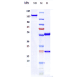 SDS-PAGE - Anti-ENPP3/B10 Antibody [Ags-16C3F] - Low endotoxin, Azide free (A324010) - Antibodies.com