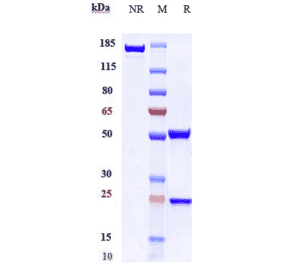 SDS-PAGE - Anti-Eph Receptor B2 Antibody [Research Grade Biosimilar] - Low endotoxin, Azide free (A324013) - Antibodies.com