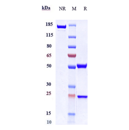 SDS-PAGE - Anti-Eph Receptor B2 Antibody [Research Grade Biosimilar] - Low endotoxin, Azide free (A324013) - Antibodies.com