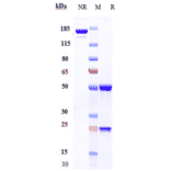 SDS-PAGE - Anti-EPO-R Antibody [Research Grade Biosimilar] - Low endotoxin, Azide free (A324017) - Antibodies.com