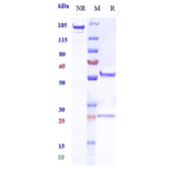 SDS-PAGE - Anti-Factor B Antibody [Research Grade Biosimilar] - Low endotoxin, Azide free (A324019) - Antibodies.com