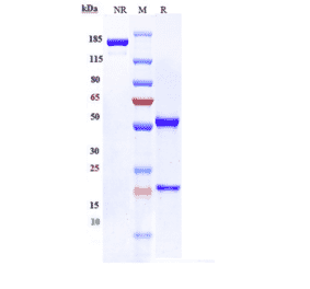 SDS-PAGE - Anti-FCRL5 Antibody [DFRF4539A] - Low endotoxin, Azide free (A324021) - Antibodies.com