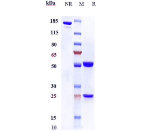 SDS-PAGE - Anti-FGF19 Antibody [1A6] - Low endotoxin, Azide free (A324022) - Antibodies.com