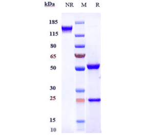 SDS-PAGE - Anti-FGFR4 Antibody [U3-1784] - Low endotoxin, Azide free (A324026) - Antibodies.com