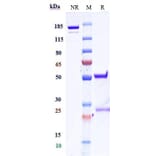 SDS-PAGE - Anti-Folate Binding Protein/FBP Antibody [Research Grade Biosimilar] - Low endotoxin, Azide free (A324029) - Antibodies.com