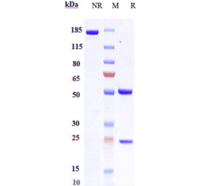 SDS-PAGE - Anti-Frizzled 7 Antibody [Research Grade Biosimilar] - Low endotoxin, Azide free (A324030) - Antibodies.com