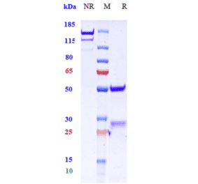 SDS-PAGE - Anti-GAD65 Antibody [Research Grade Biosimilar] - Low endotoxin, Azide free (A324032) - Antibodies.com