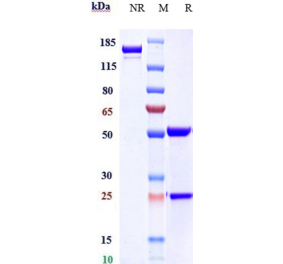 SDS-PAGE - Anti-GIPR Antibody [Research Grade Biosimilar] - Low endotoxin, Azide free (A324037) - Antibodies.com