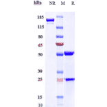 SDS-PAGE - Anti-GIPR Antibody [Research Grade Biosimilar] - Low endotoxin, Azide free (A324037) - Antibodies.com