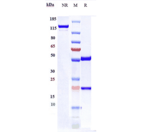 SDS-PAGE - Anti-GITR Antibody [Research Grade Biosimilar] - Low endotoxin, Azide free (A324038) - Antibodies.com