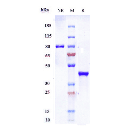 SDS-PAGE - Anti-Glucose Transporter 8 Antibody [VB1-050] - Low endotoxin, Azide free (A324040) - Antibodies.com