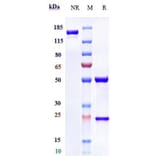 SDS-PAGE - Anti-Glypican 1/GPC1 Antibody [Research Grade Biosimilar] - Low endotoxin, Azide free (A324041) - Antibodies.com