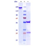 SDS-PAGE - Anti-GM-CSF Antibody [Research Grade Biosimilar] - Low endotoxin, Azide free (A324043) - Antibodies.com