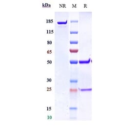 SDS-PAGE - Anti-Gremlin 1 Antibody [Research Grade Biosimilar] - Low endotoxin, Azide free (A324048) - Antibodies.com